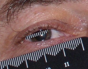 pupildiameter.jpg